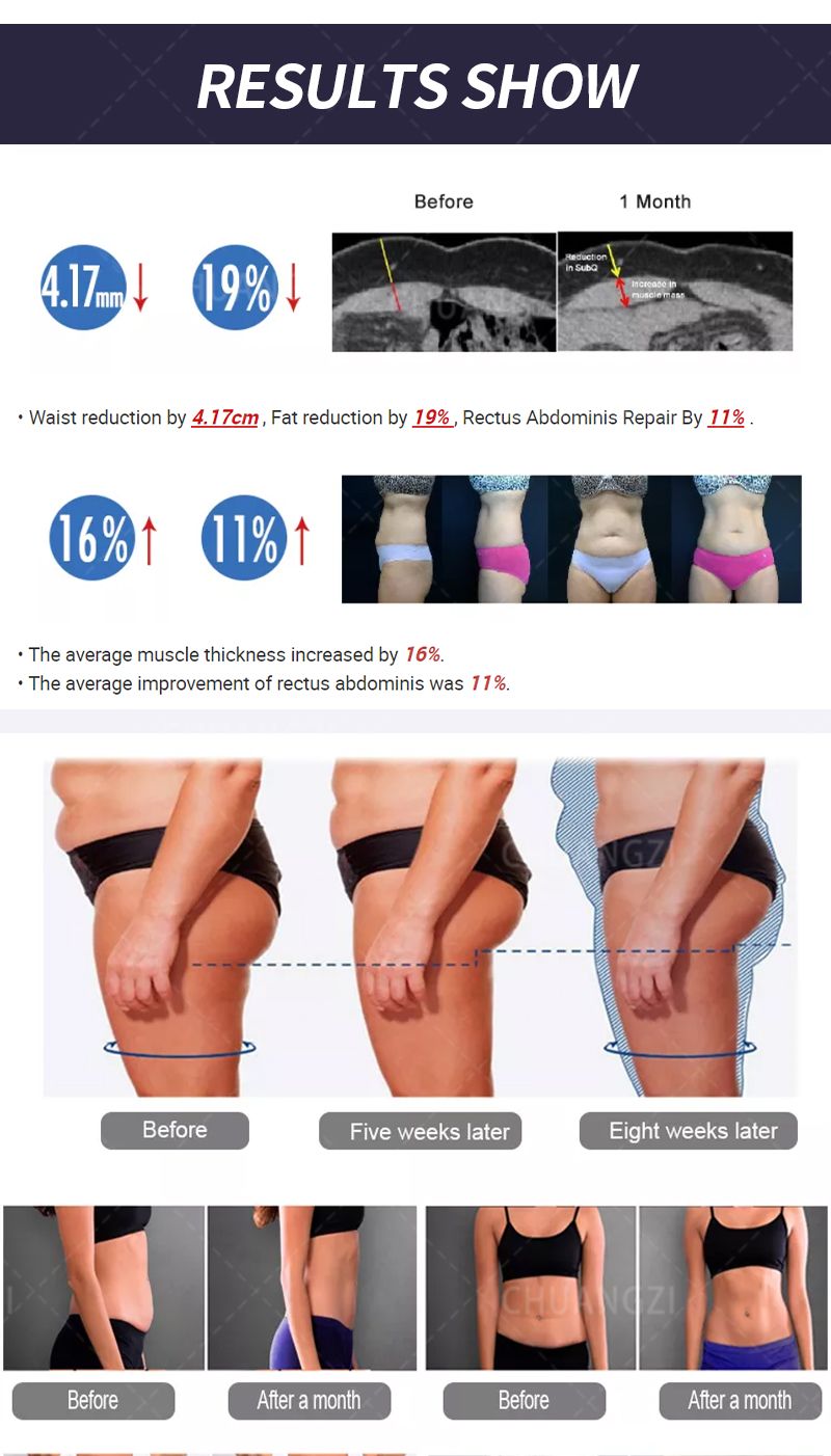 EMS Body Sculpt Machine RF Sculpting Weight Loss Burning Fat Slimming Muscle Equipment Stimulation 6500W HI-EMT MYOslim