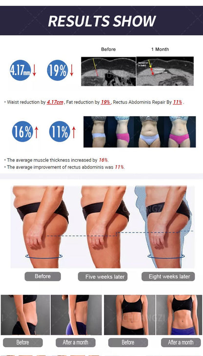 EMS Body Sculpt Machine RF Sculpting Weight Loss Burning Fat Slimming Muscle Equipment Stimulation 6500W HI-EMT MYOslim