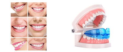 1 set Dental T4A&T4K Tooth Orthodontic Appliance Trainer for Alignment Braces Teeth Trainer for Adults Children Tooth Whitening