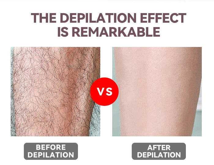 Kemei KM-290R Electric Epilator for Women Armpit Legs Bikini Sensitive Area Hair Remover Body Hair Trimmer Lady USB Rechargeable