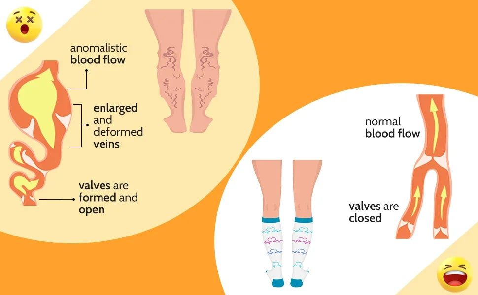 2XL-4XL Plus Size Compression Socks for Women Men 20-30 MMHg Wide Calf Extra Large Knee High Flight Sock for Circulation Support