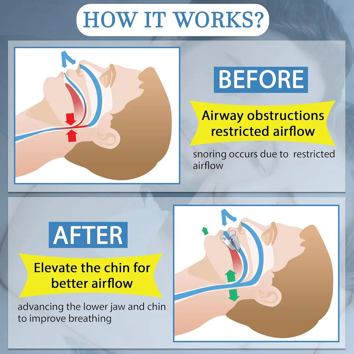Anti-Snoring Mouth Guard, Adjustable Mouthpiece - Night Time Teeth Mouthguard & Sleeping Bite Guard for Bruxism and Stop Snoring