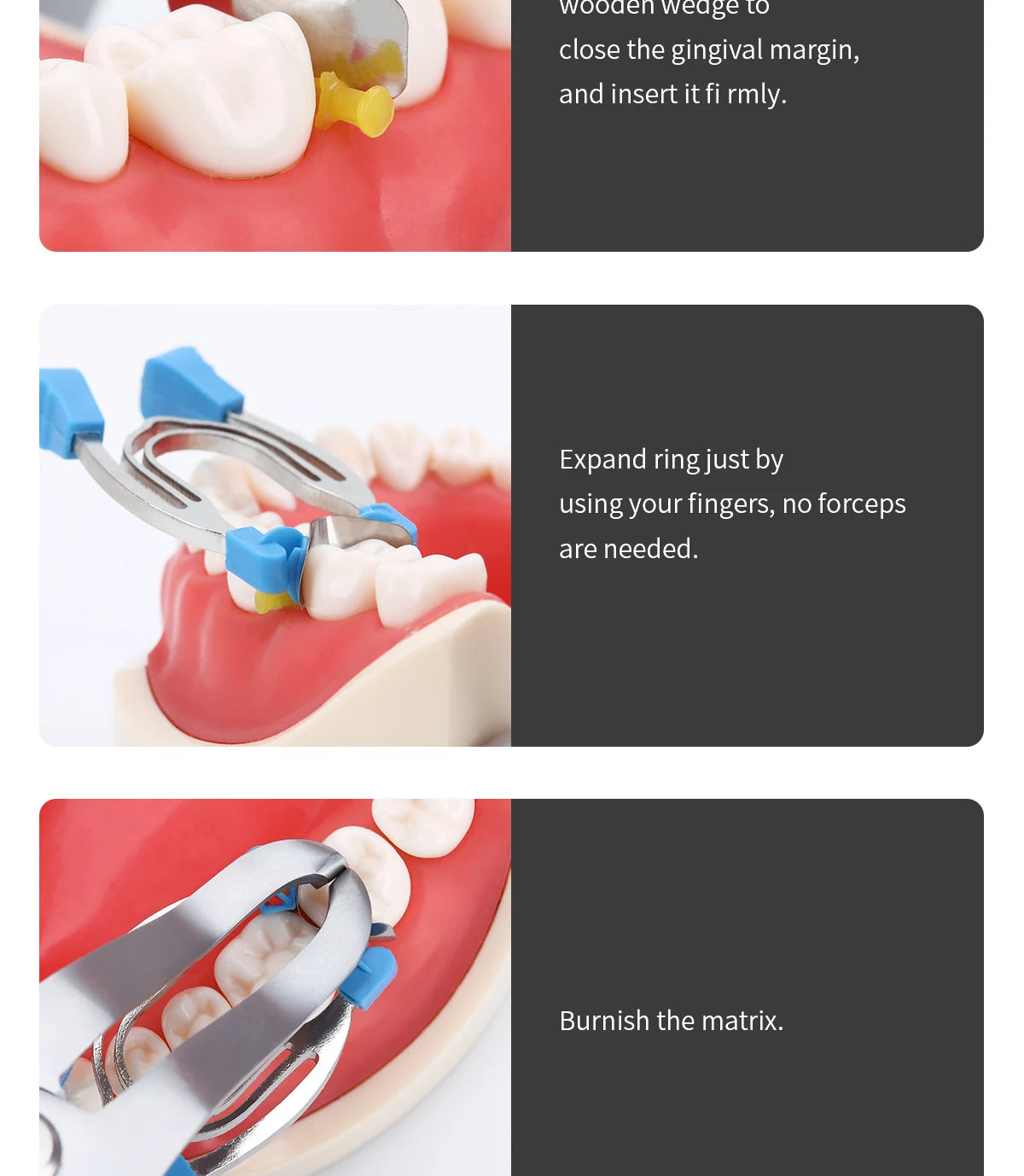 Azdent Dental Matrix Sectional Contoured Metal Spring Clip Rings Clamps Wedges Dentist Tools