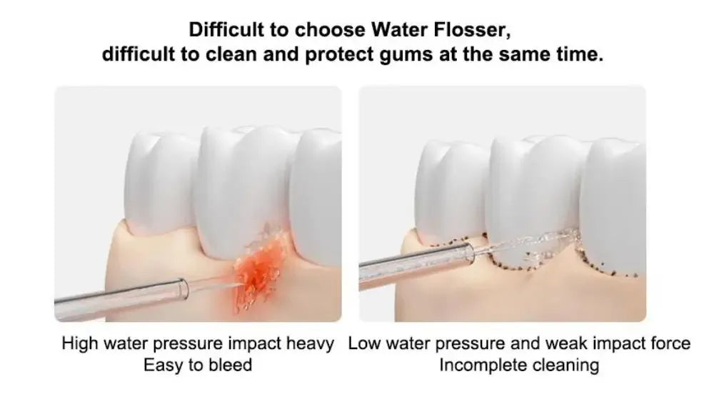NEW MIJIA MEO705 Portable Oral Irrigator 2 Dental Teeth Whitening Flosser Bucal Tooth Cleaner Waterpulse Water Thread for Teeth