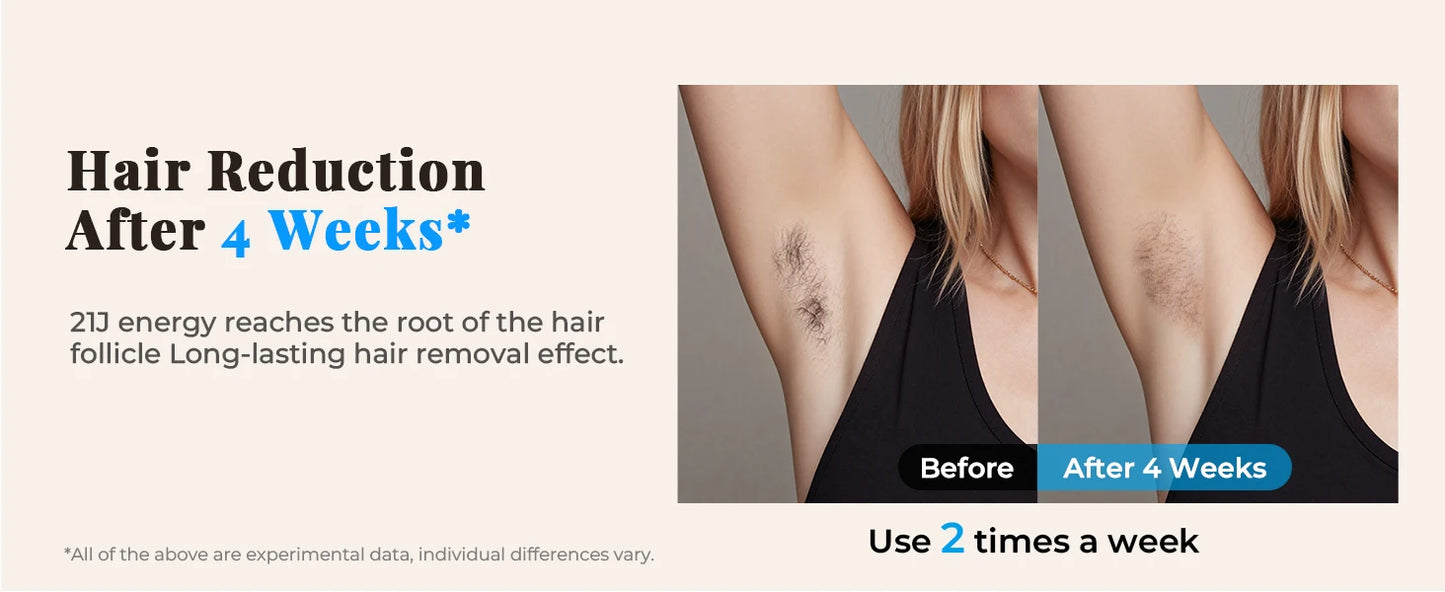 Haarlosy IPL Devices Hair Removal Laser Painless Hair Removal Device with HR/SC/RA, 9 Levels, 999,900 Flashes at Home for Women