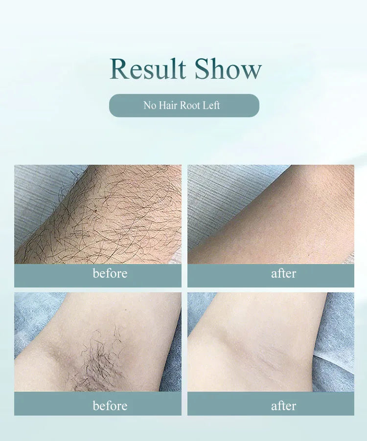 Vancostar Portable Laser Hair Removal Handset 900000 Flashes Painless Permanent Hair Remove for Women At-Home IPL Epilator
