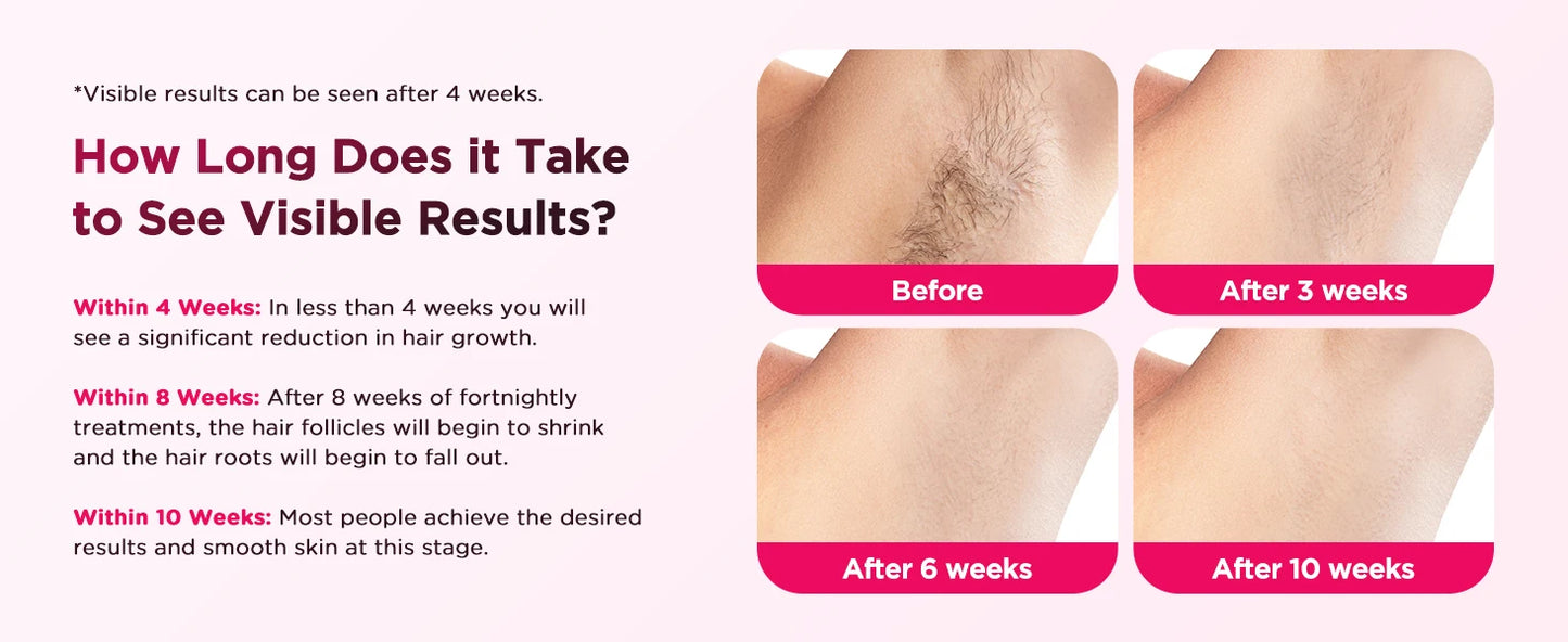 IPL Hair Removal Device Ice-Cooling 3 in 1 Painless 16J Photoepilator Permanent Whole Body Home Treament For Men and Women