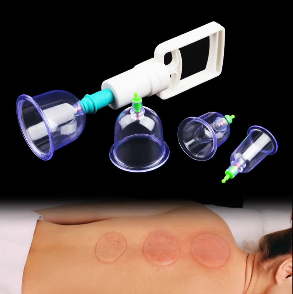 6-Piece Suction Cup Set with Hand Pump – Vacuum Cupping Tool for Back & Body Use