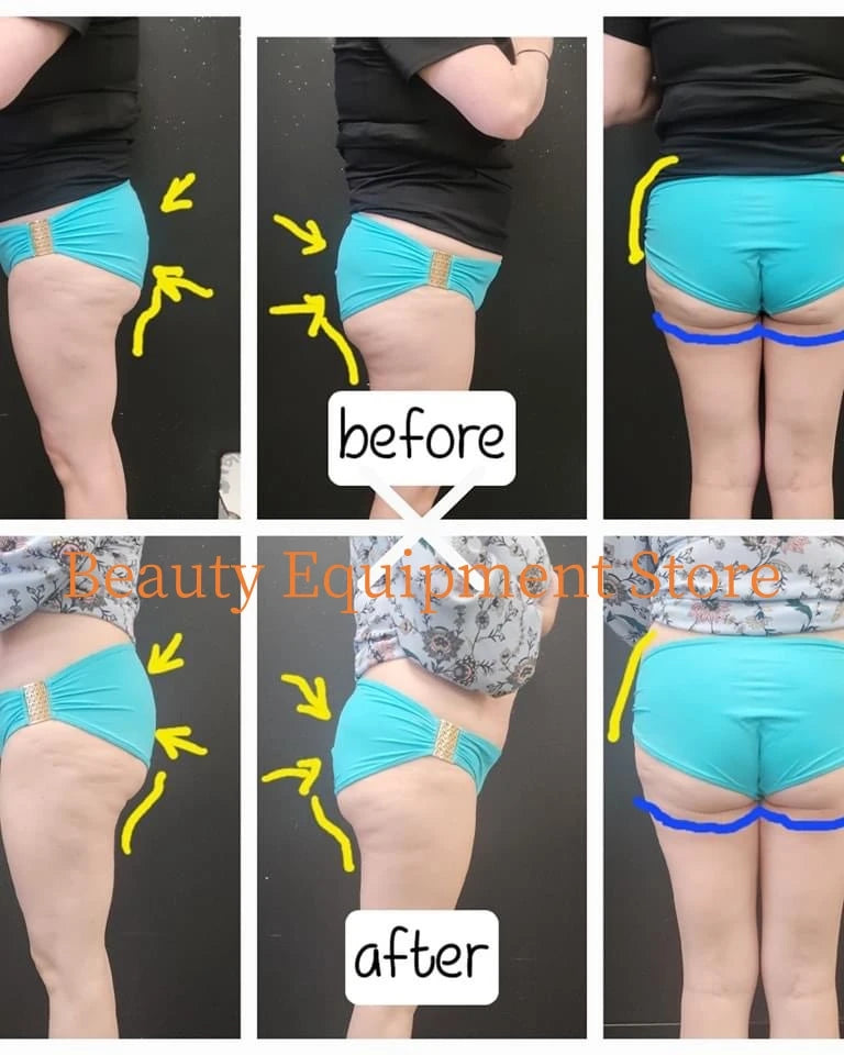 EMS Body Sculpt Machine RF Sculpting Weight Loss Burning Fat Slimming Muscle Equipment Stimulation 6500W HI-EMT MYOslim
