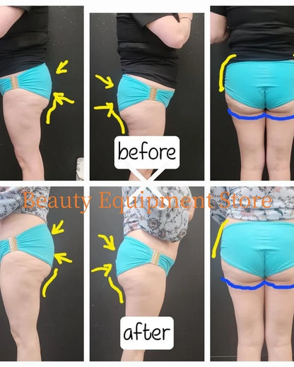 EMS Body Sculpt Machine RF Sculpting Weight Loss Burning Fat Slimming Muscle Equipment Stimulation 6500W HI-EMT MYOslim
