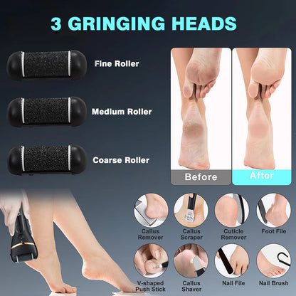 Electric Callus Remover Professional Foot File Pedicure Machine 3 Heads Adjustable Speeds Rechargeable Heel Dead Skin Scrubber