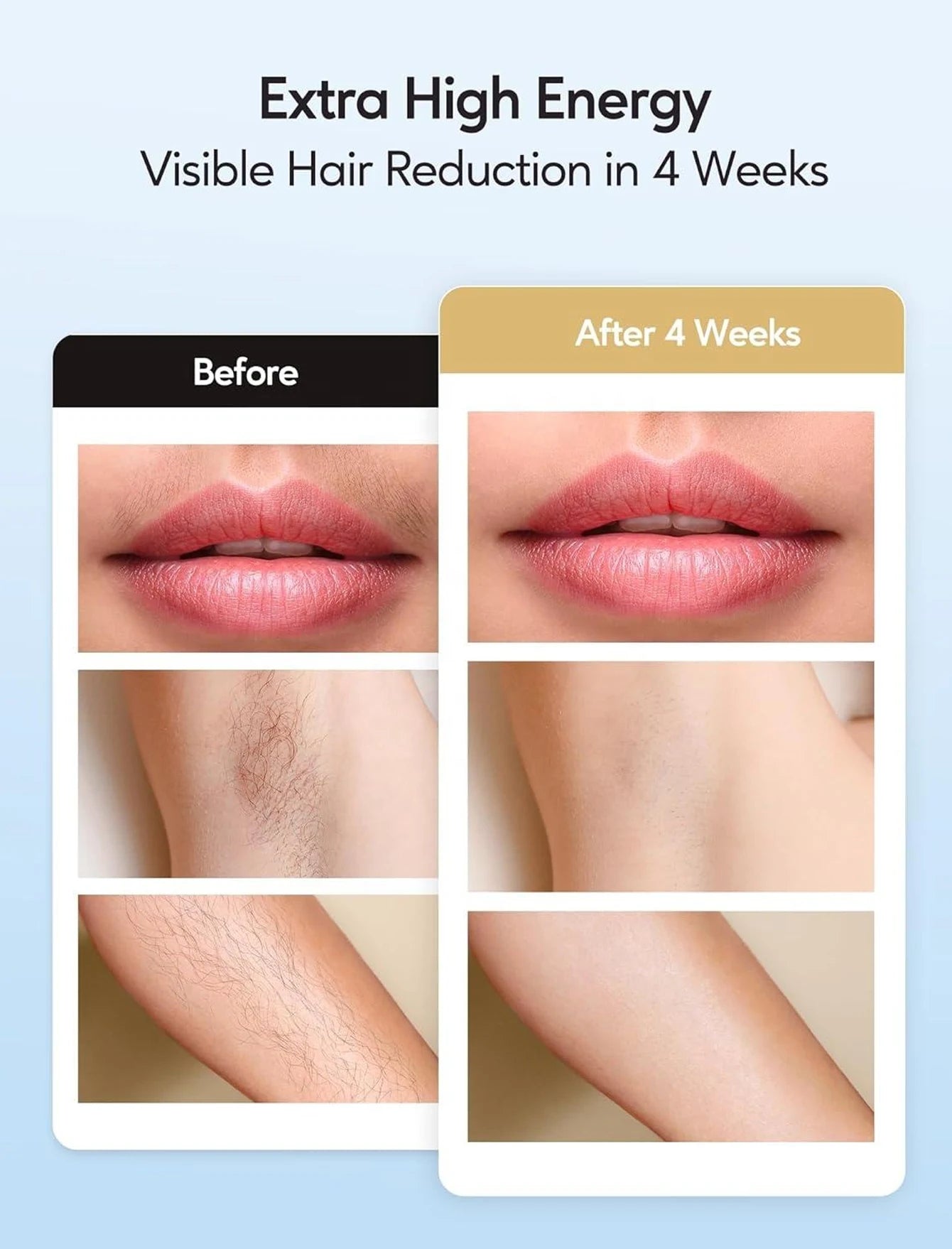 IPL Hair Removal with Ice Cooling Care Function for Women Permanent,999,999 Flashes Painless IPL Hair Remover Device