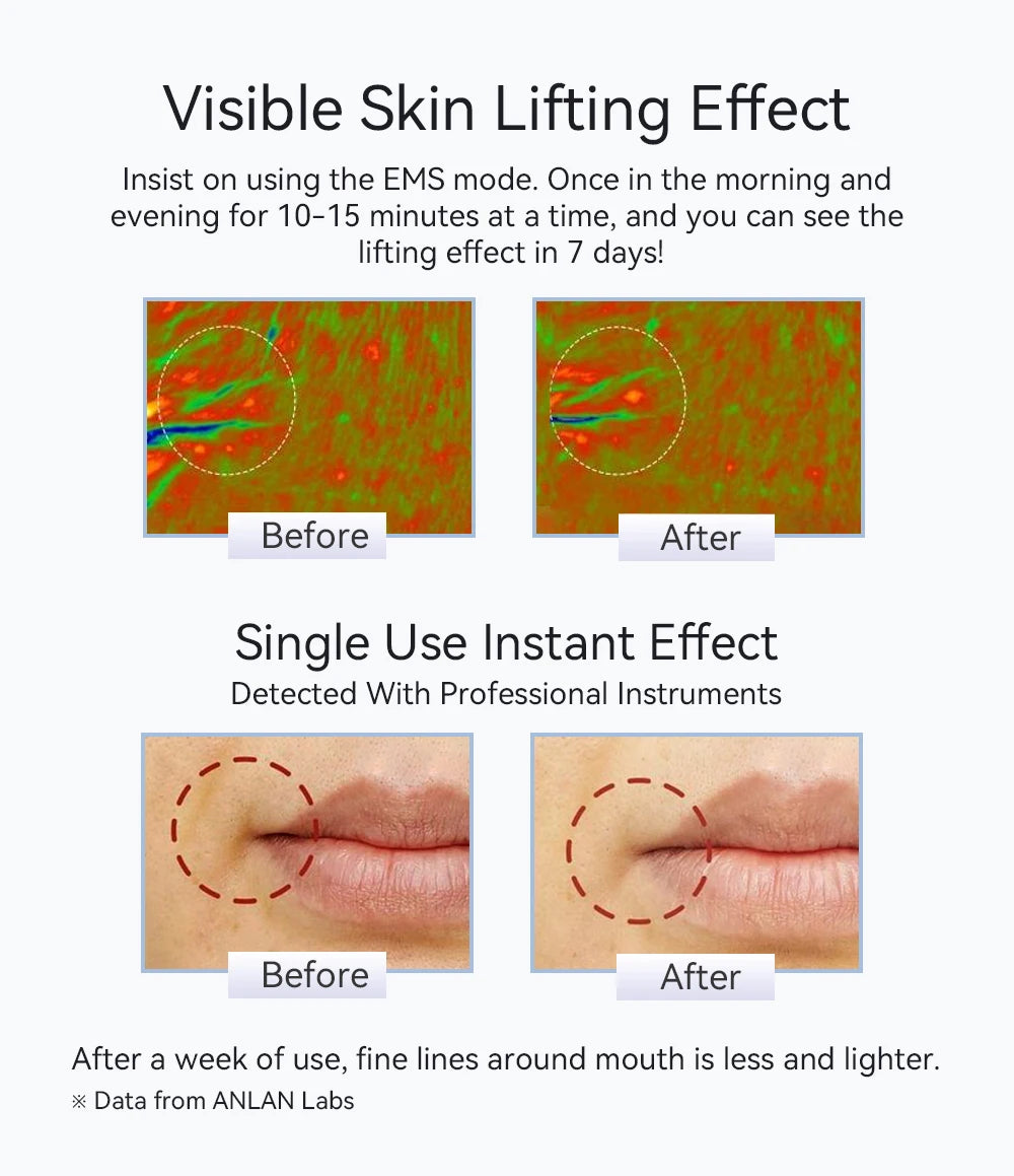 ANLAN Facial Massager Pro Microcurrent Face Lifting Skin Rejuvenation with Cold Deep Cleaning Anti-aging Skincare Beauty Device
