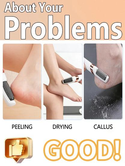 foot callus remover foot scrubber foot grinder feet skin remover exfoliator foot dry skin,free shipping