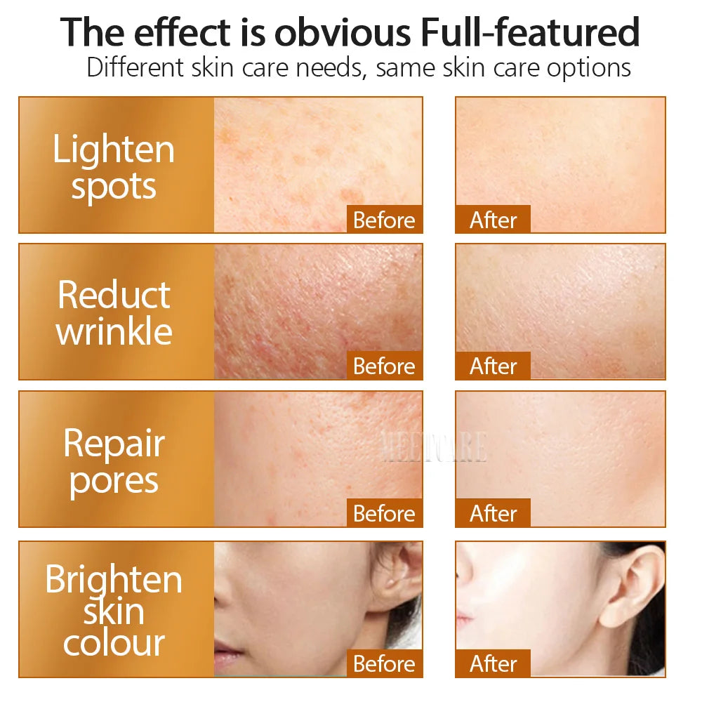 ZGTS 192 Needle Derma Roller Micro Needle Dermaroller Mesotherapy Face Care and Hair-loss Scar Stretch Mark Removal
