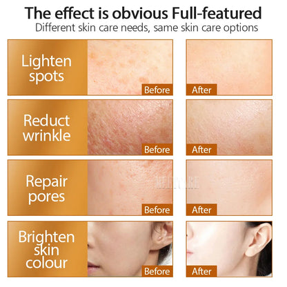 ZGTS 192 Needle Derma Roller Micro Needle Dermaroller Mesotherapy Face Care and Hair-loss Scar Stretch Mark Removal