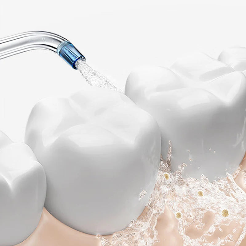 MIJIA Electric Oral Irrigator Upgraded version – Ultrasonic, 90-Day Gentle Use,Water Flosser Dental, 3 Modes, 200mL Tank
