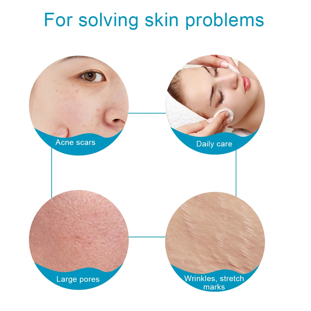 540 Needles Derma Roller for Facial Body Hair Growth Skin Care Microneedling Tool Microneedle Derma Roller Face MicroNeedle Roll