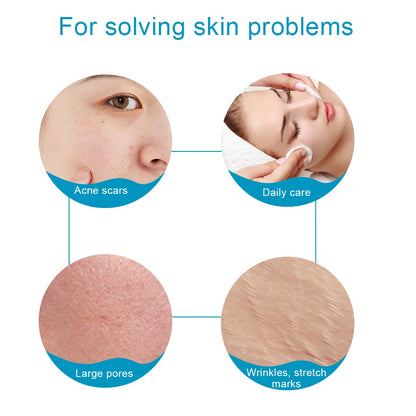 540 Needles Derma Roller for Facial Body Hair Growth Skin Care Microneedling Tool Microneedle Derma Roller Face MicroNeedle Roll
