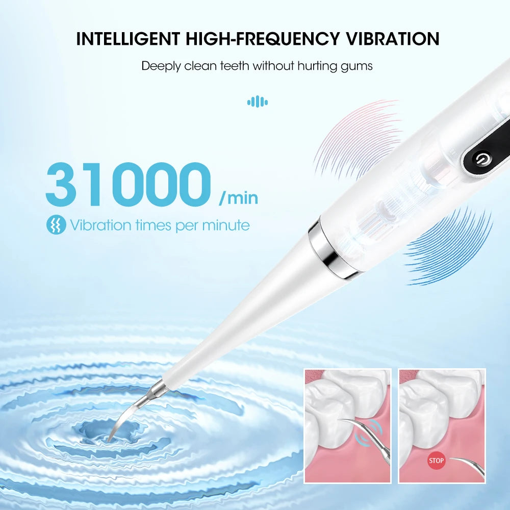 Electric Dental Scaler For Teeth Tartar Stain Tooth Calculus Remover Electric Teeth Plaque Cleaner Dental Stone Removal