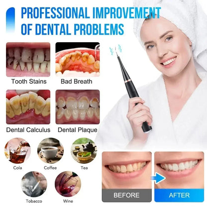 Ultrasonic Electric Sonic Dental Scaler Stain Tartar Calculus Remover Teeth Whitening Cleaning Oral Irrigator Electric