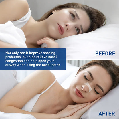 Extra Strength Sport Nasal Strips - Breathable Anti-Snoring Non-Invasive Sleep Aid for Adults And Children 30/90/150/300 PCS