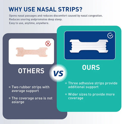 Extra Strength Sport Nasal Strips - Breathable Anti-Snoring Non-Invasive Sleep Aid for Adults And Children 30/90/150/300 PCS