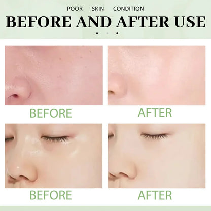 1~5PCS Green Tea Clay Stick For Face Green Mask Stick Smear Acne Shrink Blackhead Green Tea Extract Facial Mask Pore Cleansing