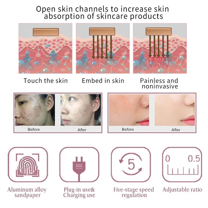 Ultima Dr.imp Pen Wireless Derma Rolling Dermapen Microneedling Cartridge Mesotherapy Auto Micro Needles Exfoliate Shrink Pores