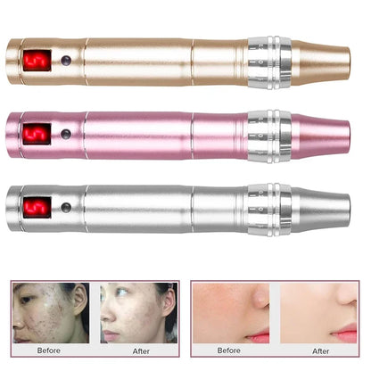 Ultima Dr.imp Pen Wireless Derma Rolling Dermapen Microneedling Cartridge Mesotherapy Auto Micro Needles Exfoliate Shrink Pores
