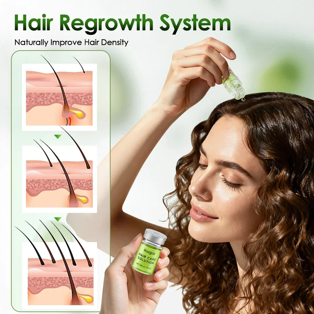 1/2/3 Boxes Hair Essential Care Serum strengthen roots Reducing Loss Prevent Baldness Nourishing Regrow Hair Care Essence