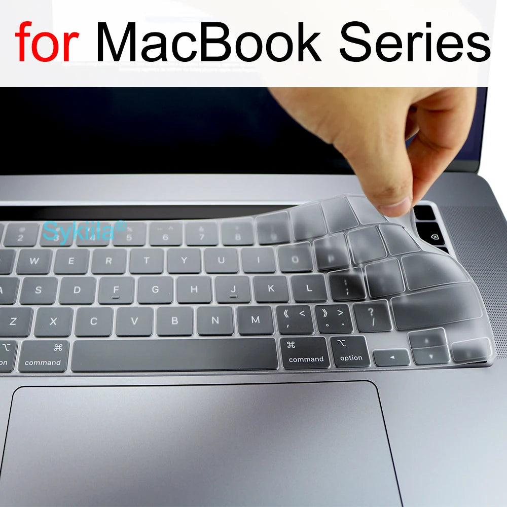 Case for Macbook Air 13 M3 M1 Pro 13 14 15 16 M4 Max 12 11 13.6 Retina Hard Cover Shell Print A3401 A3114 A2992 A3185 A3112 2024