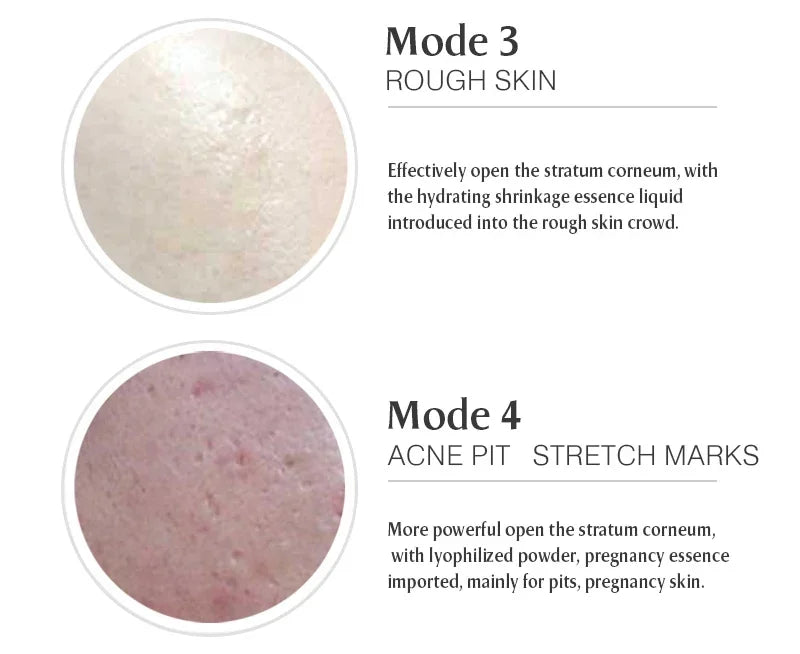 Ultima Dr.imp Pen Wireless Derma Rolling Dermapen Microneedling Cartridge Mesotherapy Auto Micro Needles Exfoliate Shrink Pores