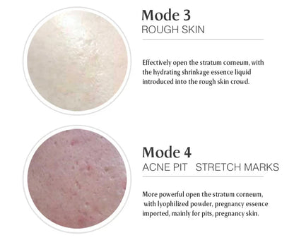 Ultima Dr.imp Pen Wireless Derma Rolling Dermapen Microneedling Cartridge Mesotherapy Auto Micro Needles Exfoliate Shrink Pores